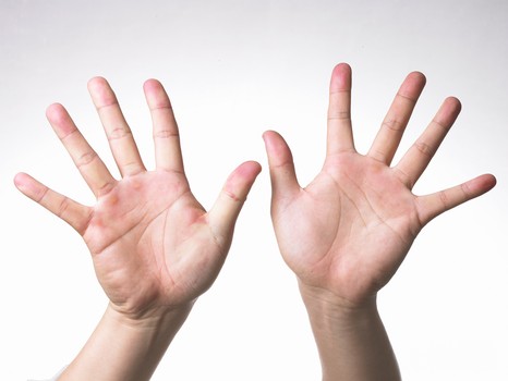 右手手心痒预兆,右手心痒是发财预兆吗