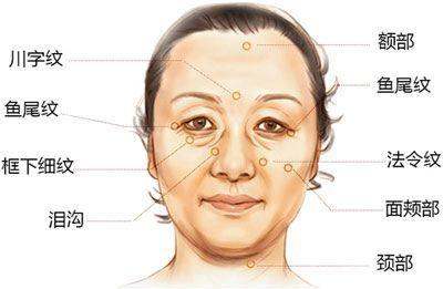 女人脸上有法令纹面相,女人的法令纹的面相